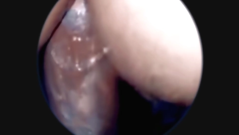 Beautiful anal sex from an amateur anal porn video